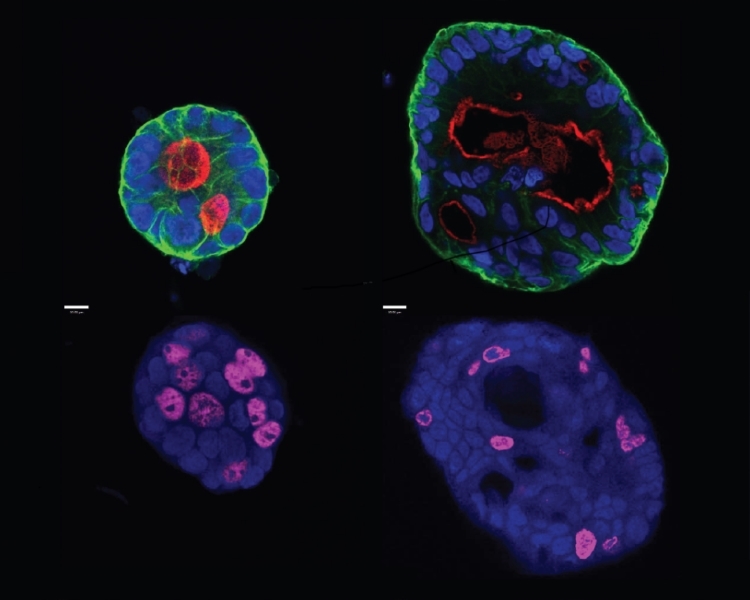 Fluorescent staining of cancer organoid models. Credit: Hayley Francies, Wellcome Sanger Institute.